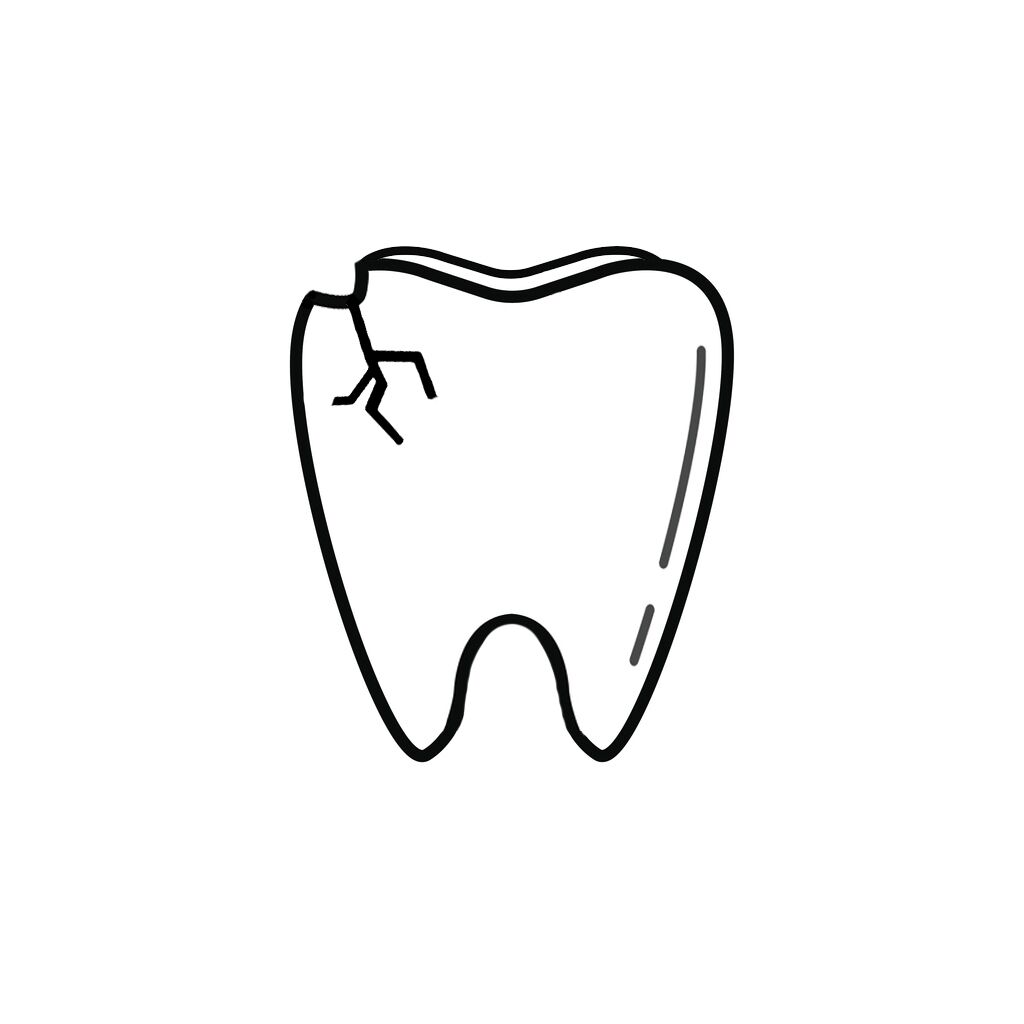 Huntsville AL Dentist | I Chipped a Tooth! What Can I Do?
